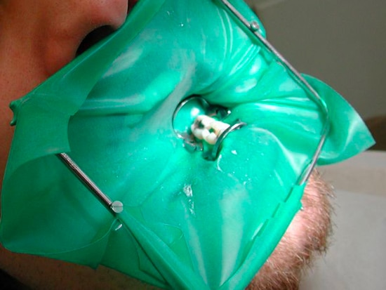 La digue dentaire – Docteur Rindel
